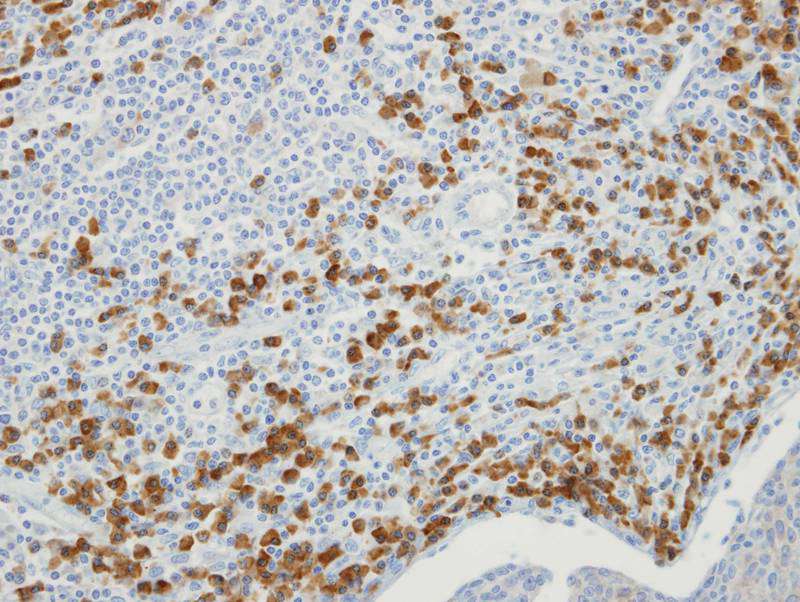 MTMR9 antibody
