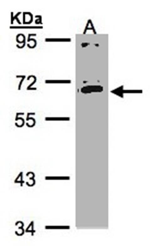 IL17 receptor C antibody