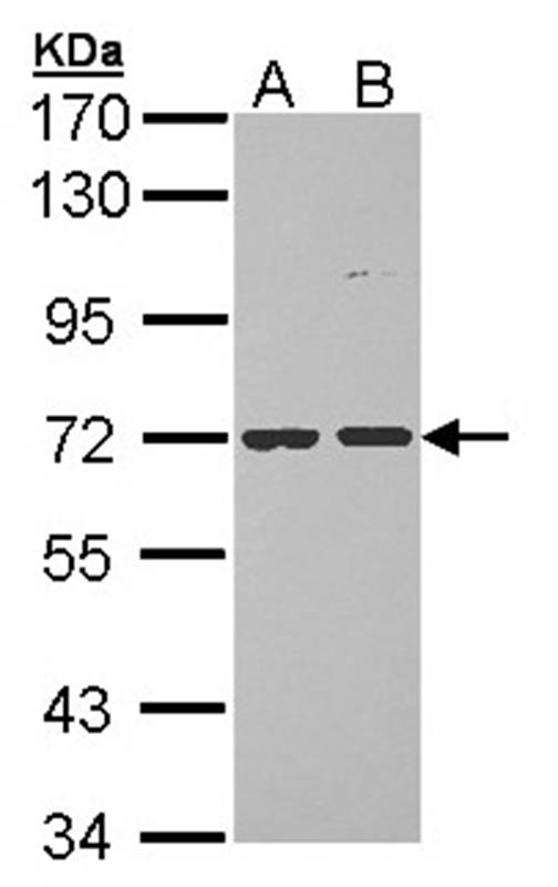 POMGNT1 antibody
