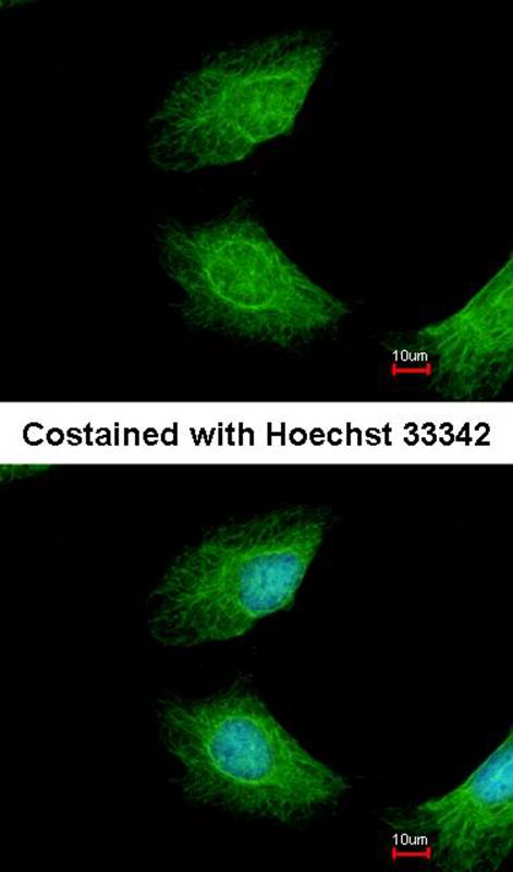 Anamorsin antibody