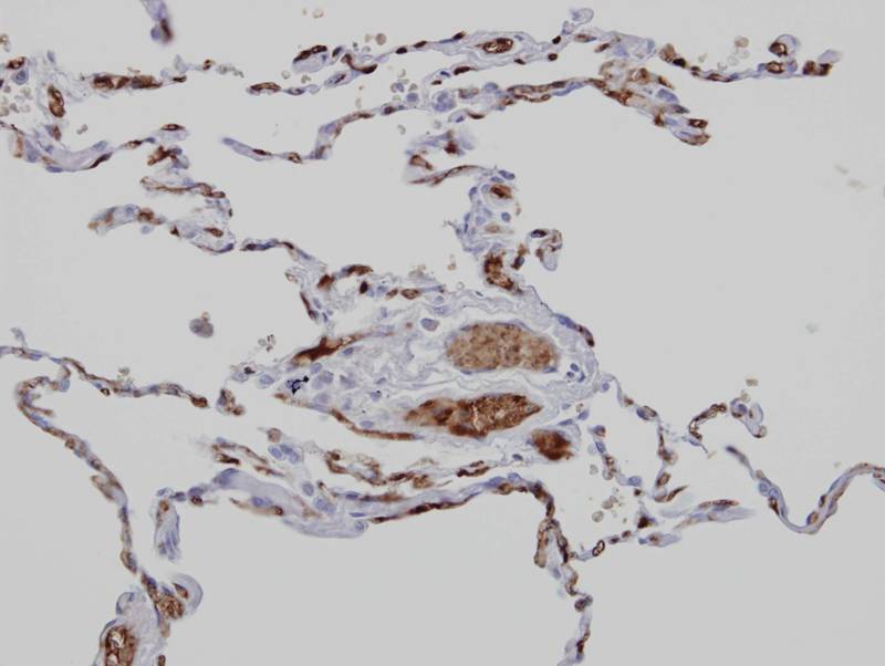 Anamorsin antibody