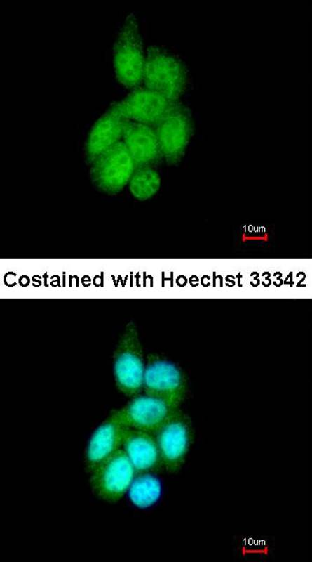 BAIAP2L1 antibody