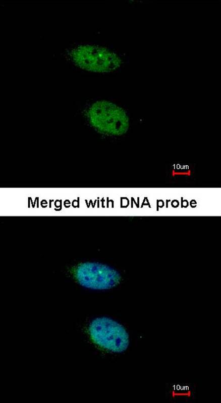 PRPS2 antibody