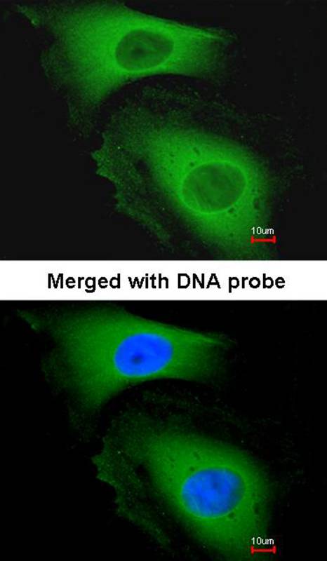 LARS2 antibody
