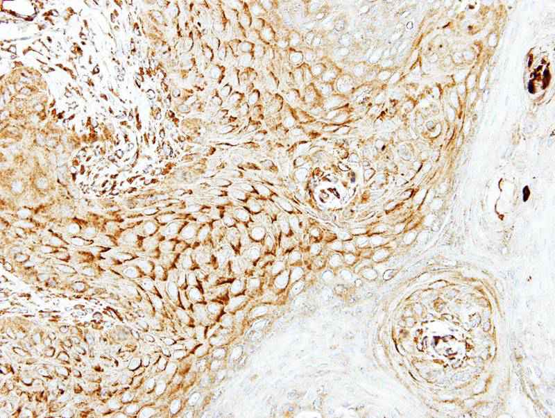 LARS2 antibody