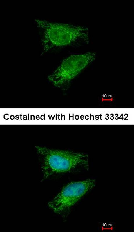 TBRG4 antibody