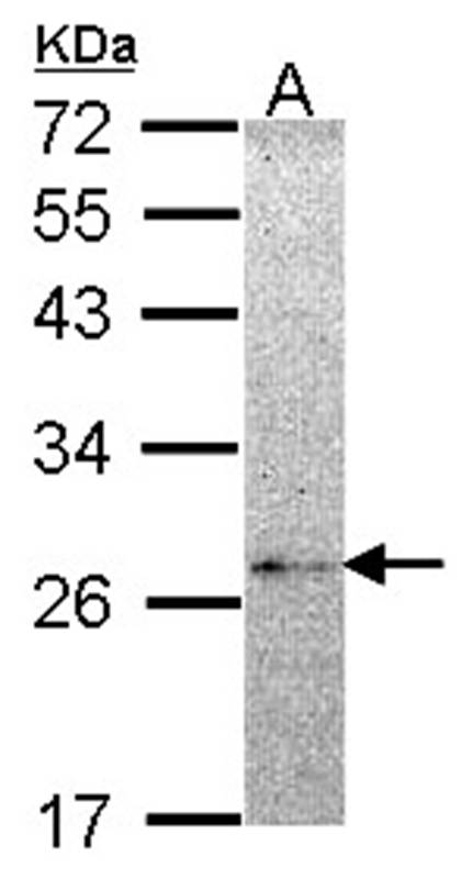 NME5 antibody