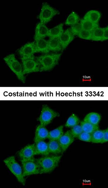 calcium binding protein P22 antibody