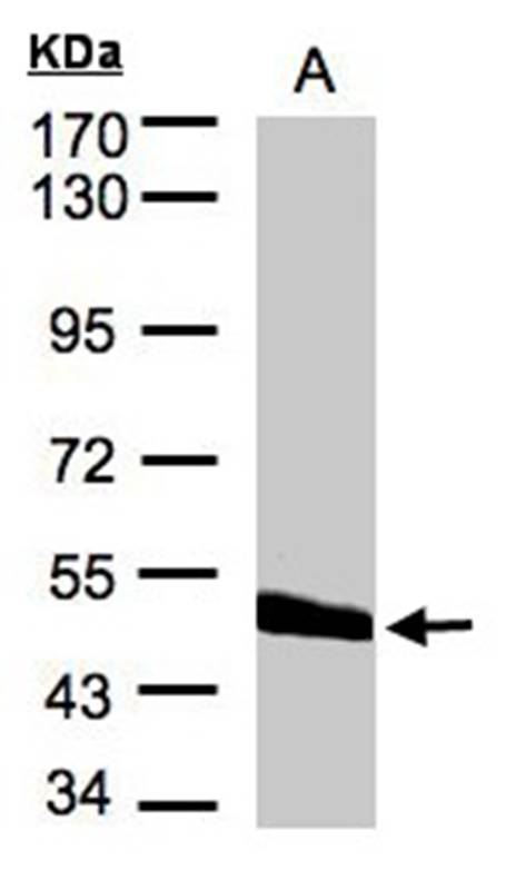 CPVL antibody