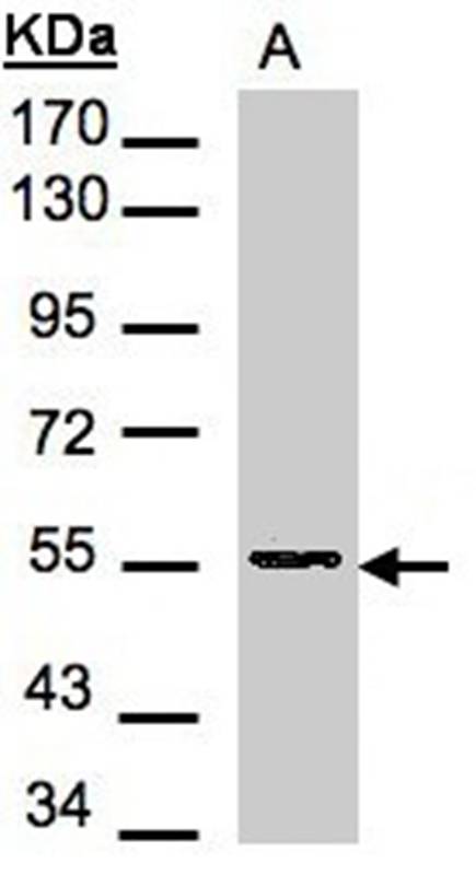 Aspartyl aminopeptidase antibody