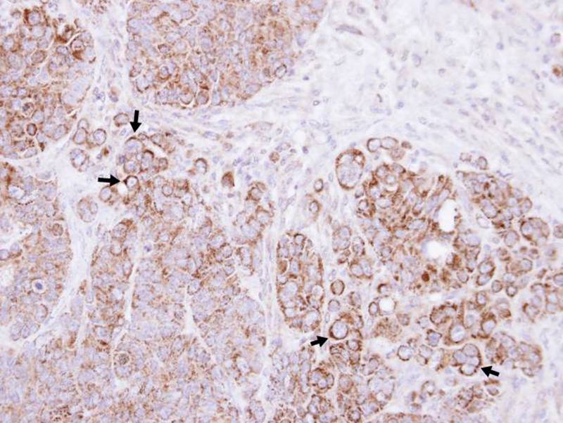 Alpha-catulin antibody