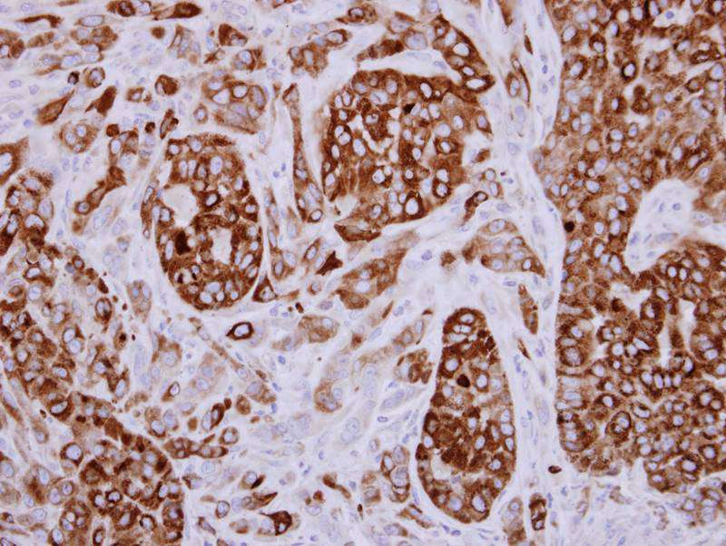 AGR3 antibody