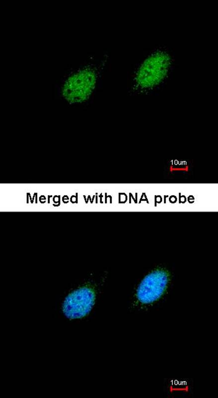 serine/threonine kinase 40 antibody