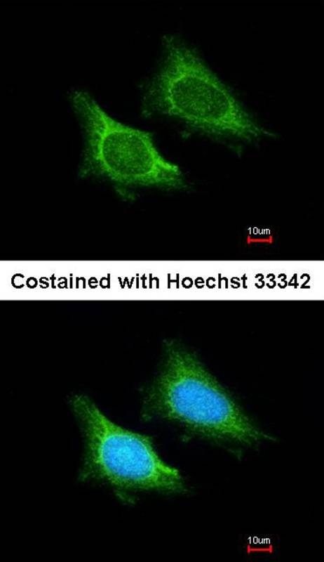 MRPS5 antibody