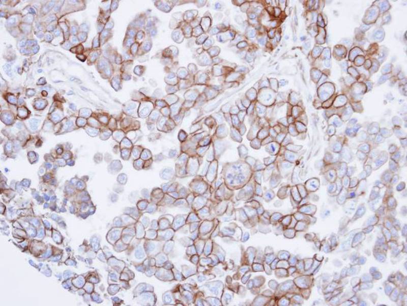 basic beta 2 syntrophin antibody