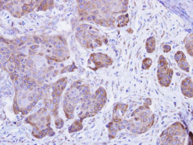 Calsequestrin-2 antibody