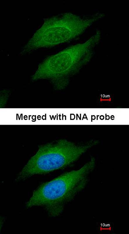 DPRP1 antibody