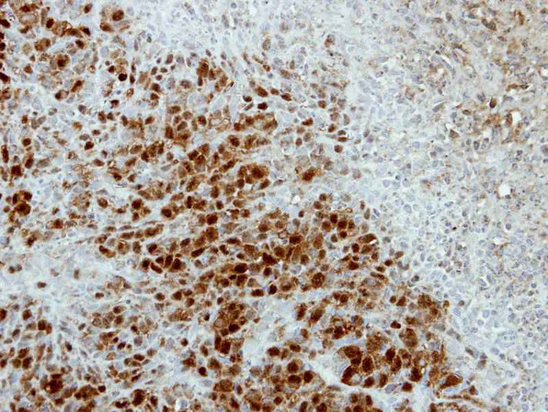 ARSA antibody