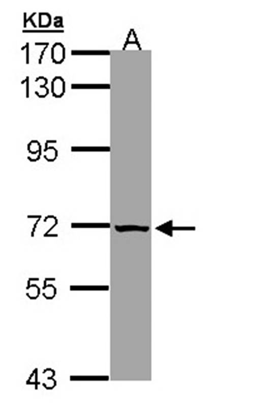 SLC25A13 antibody