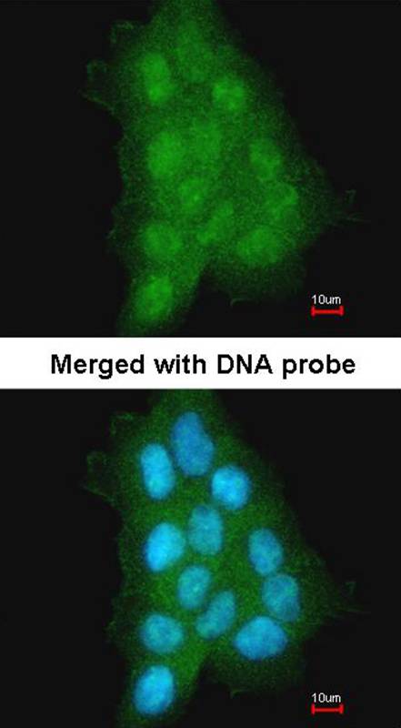 MAGEA11 antibody