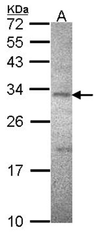 ATPase beta3(Na+/K+) antibody