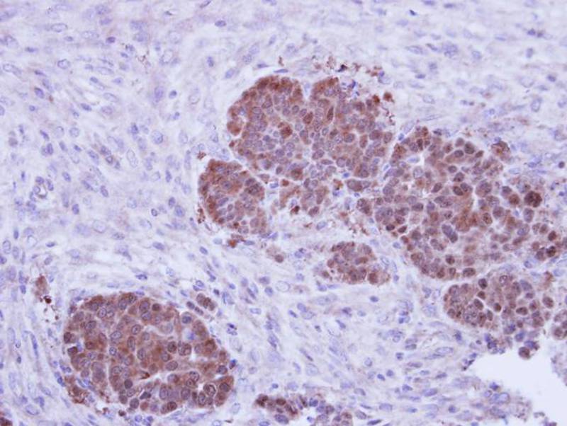 ZNF259 antibody
