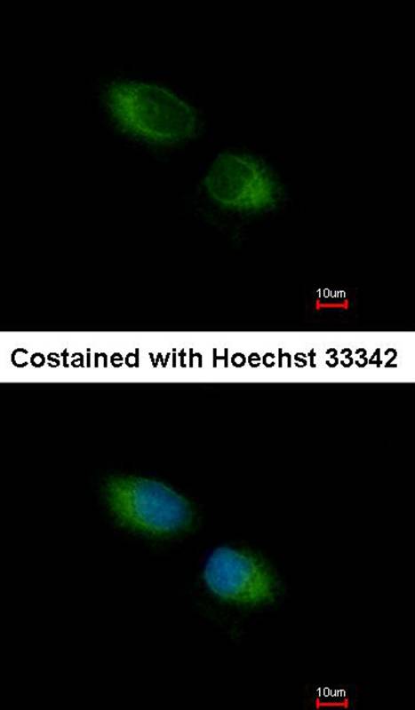 TXNDC1 antibody