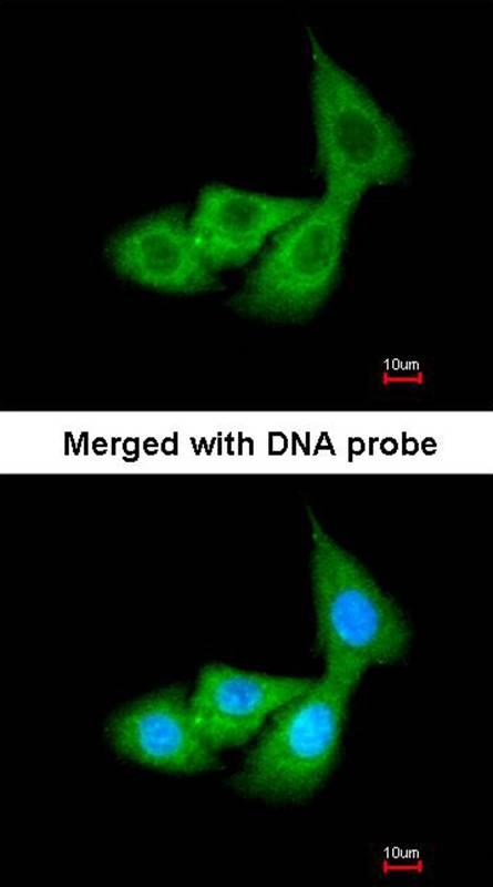 Cortisol Binding Globulin antibody
