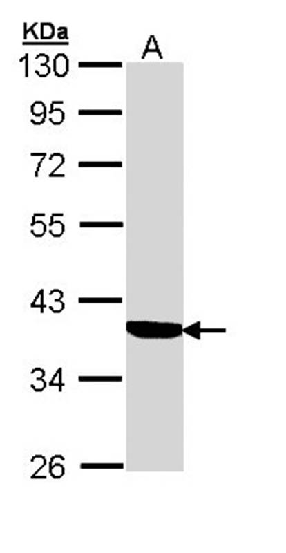 Cortisol Binding Globulin antibody