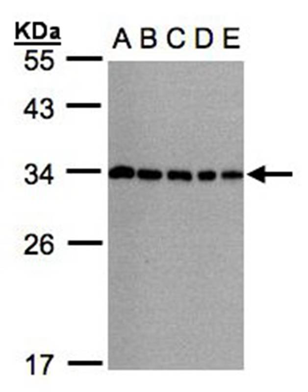 CHMP5 antibody