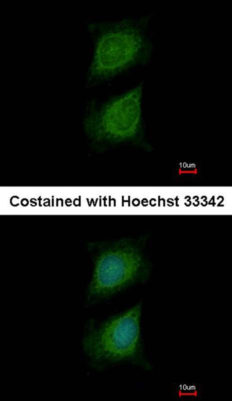 Plexin-D1 antibody