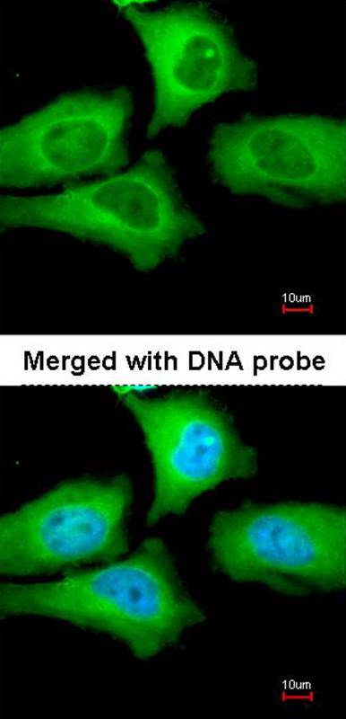 TCP-1 epsilon antibody