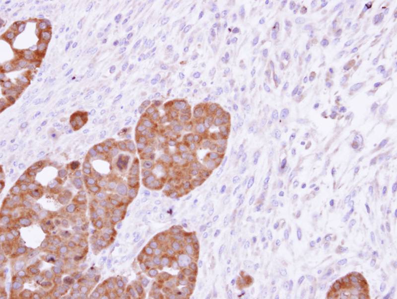TCP-1 epsilon antibody