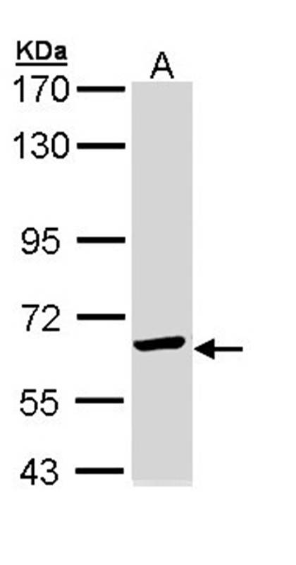 TCP-1 epsilon antibody