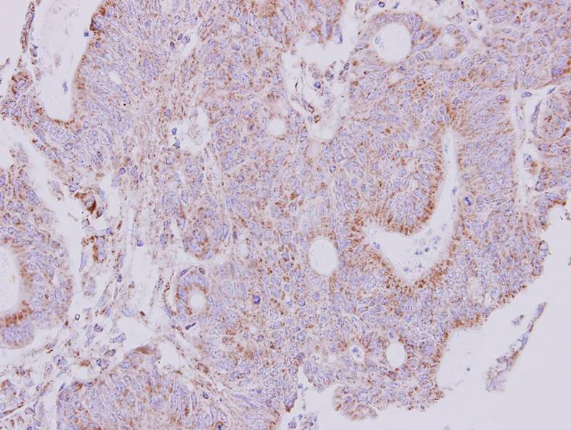 NDUFS1 antibody