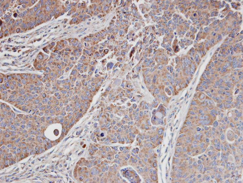 MRCKalpha antibody