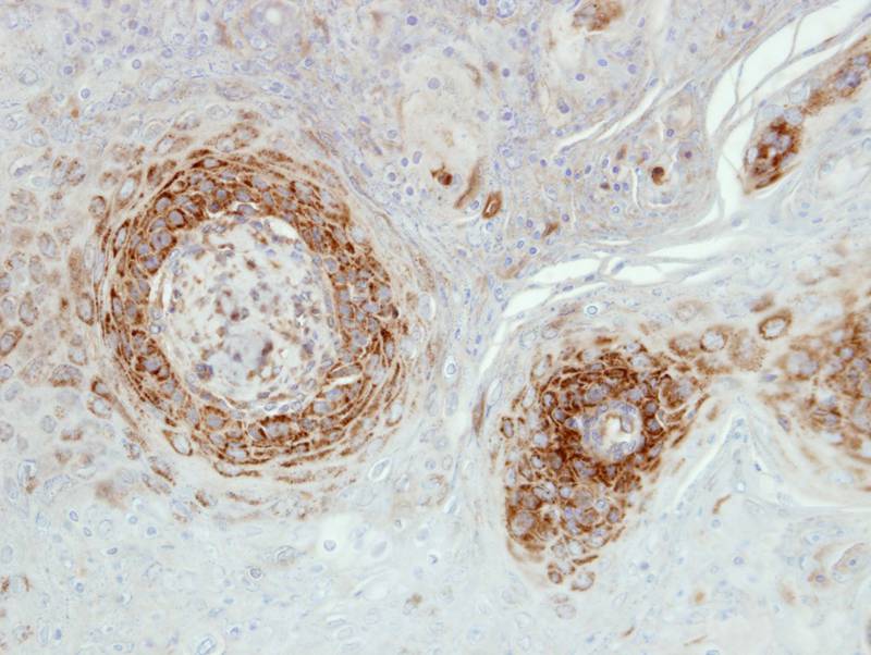 NDUFA5 antibody