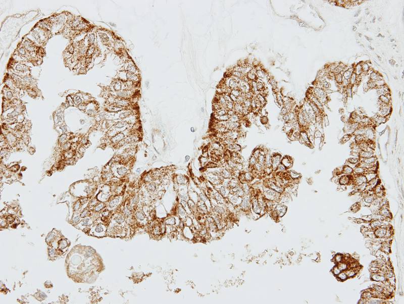 GEM antibody