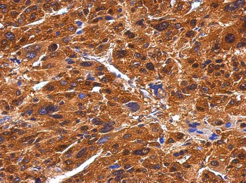BIVM antibody