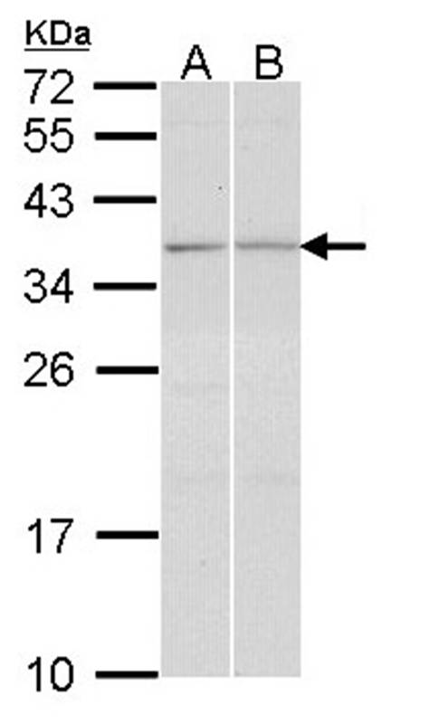 TGF beta induced factor 2 antibody