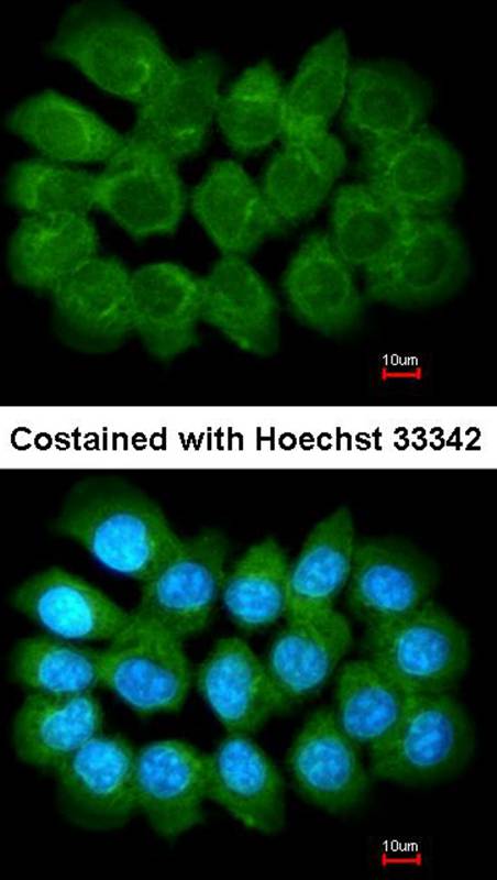 Liprin alpha 1 antibody