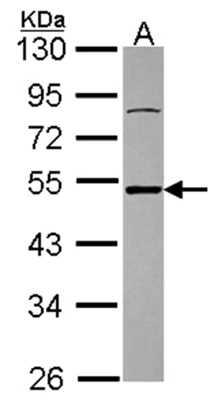 Ataxin 3 antibody