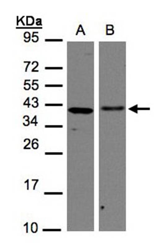 EMAP II antibody