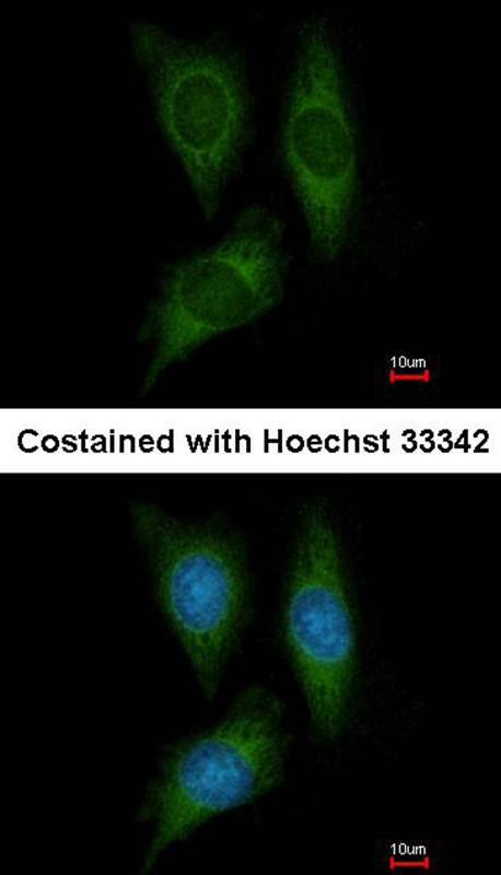 STK25 antibody