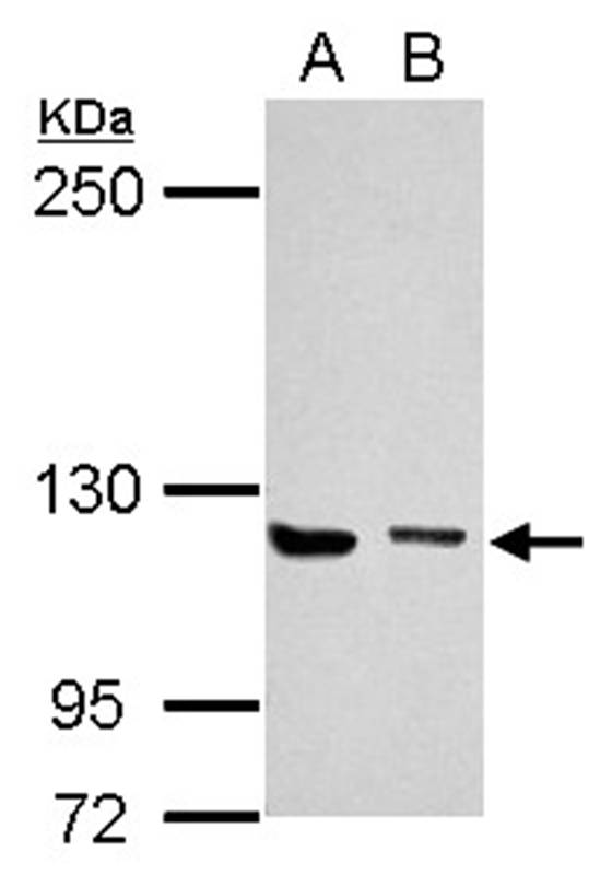 UNC13D antibody