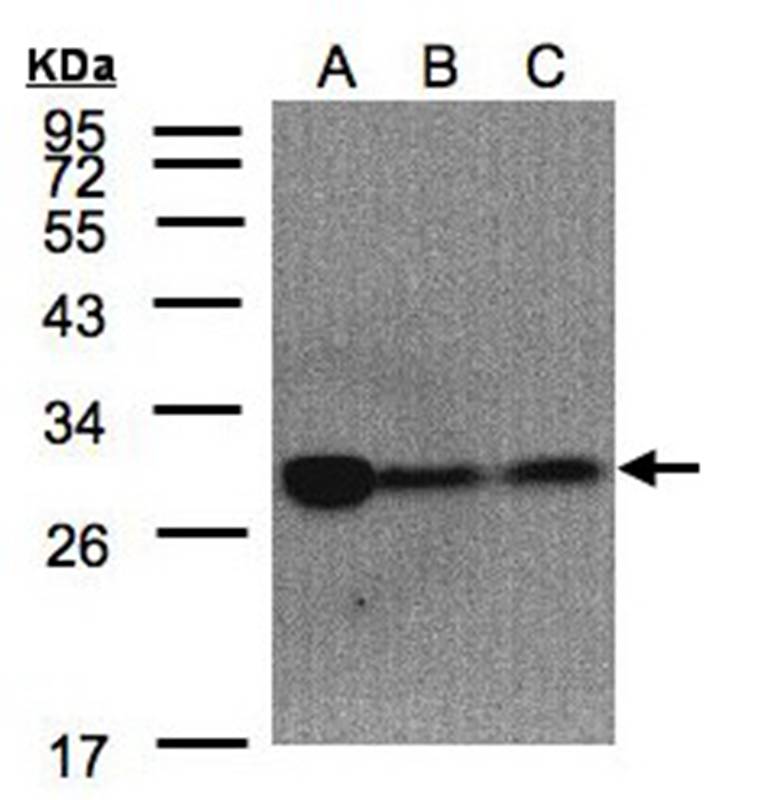 ClpP antibody