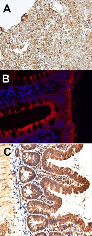 JAM-B antibody