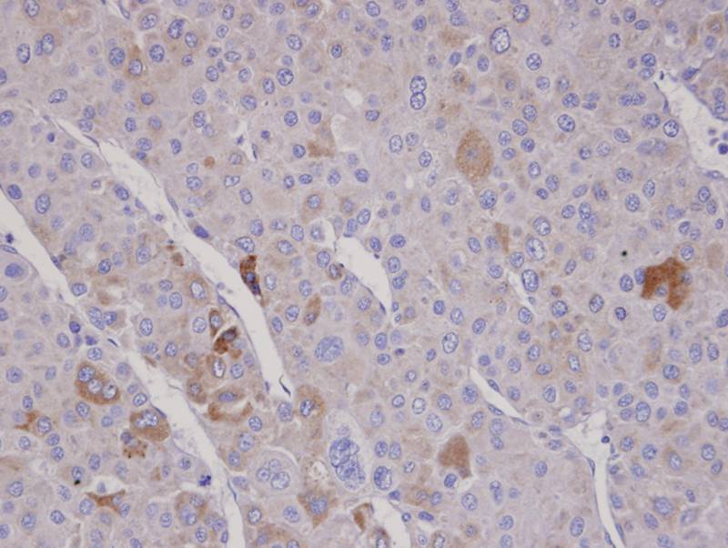 F-box only protein 2 antibody