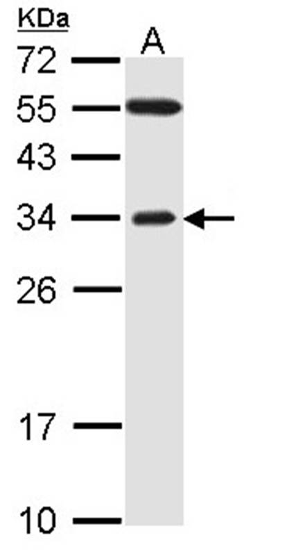 F-box only protein 2 antibody