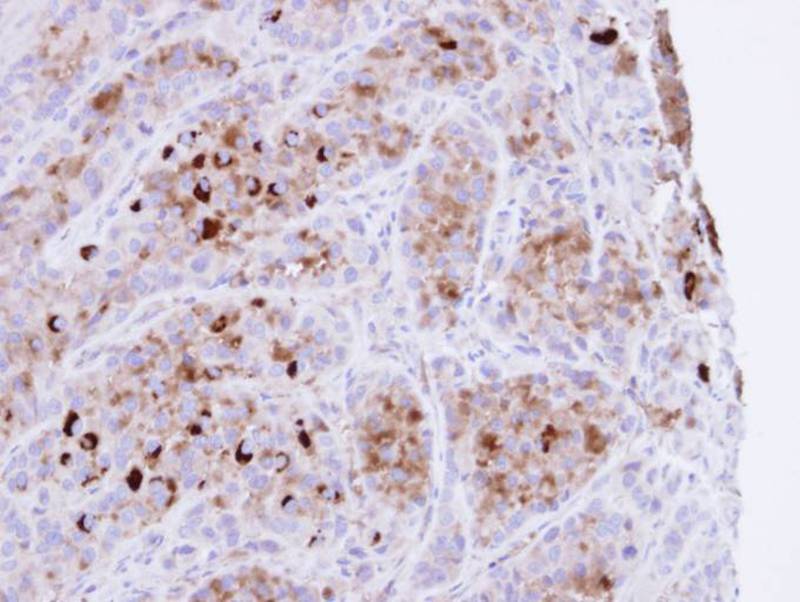 CRHSP-24 antibody